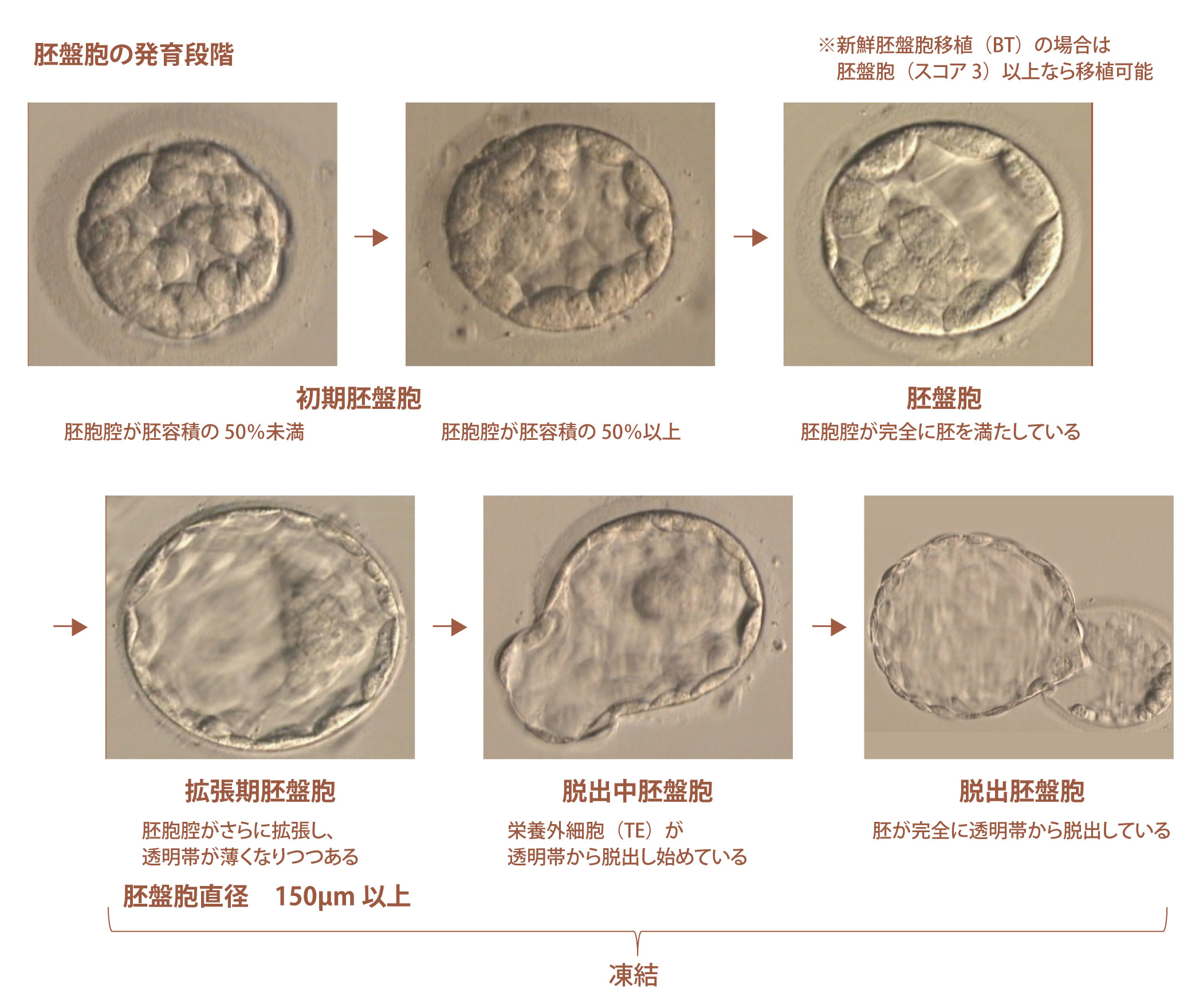 図：胚盤胞