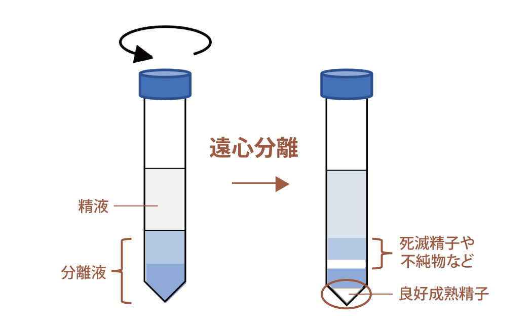 図：密度勾配遠心法