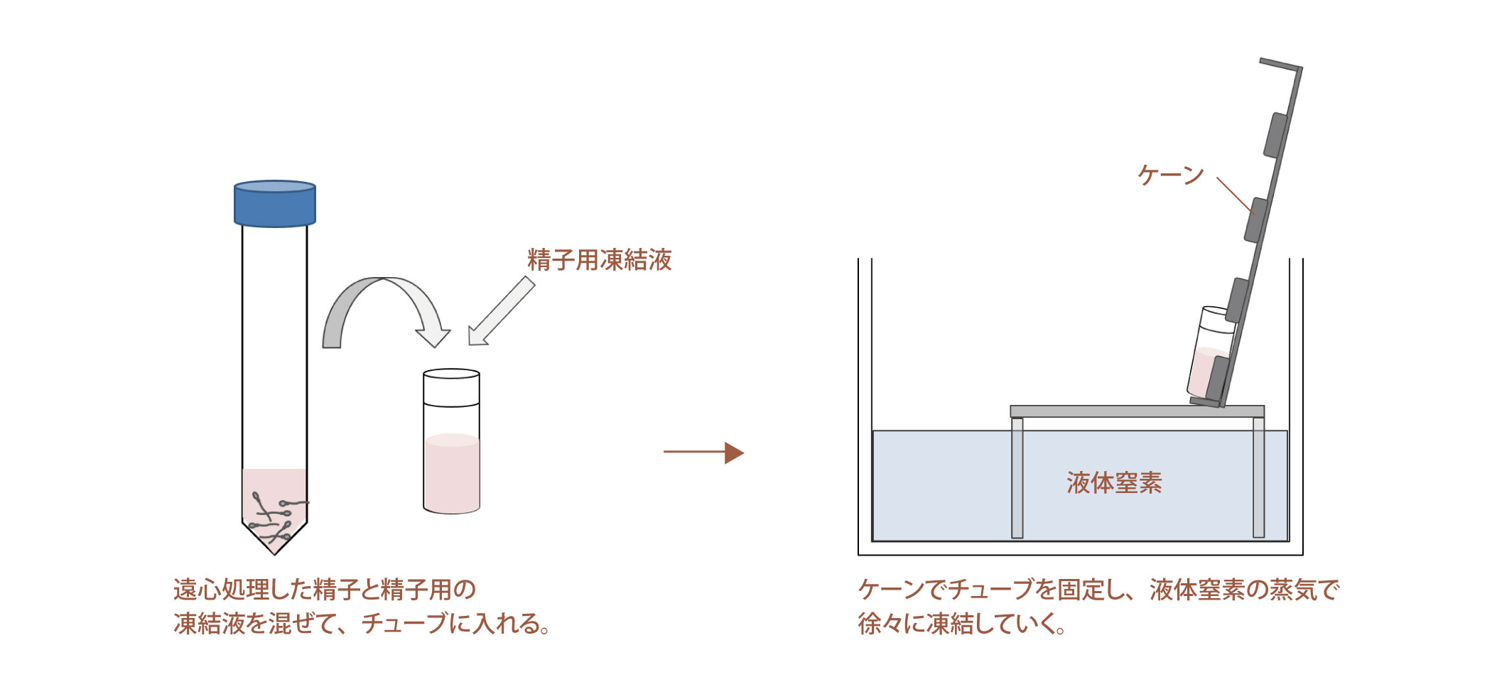 図：凍結（精子）