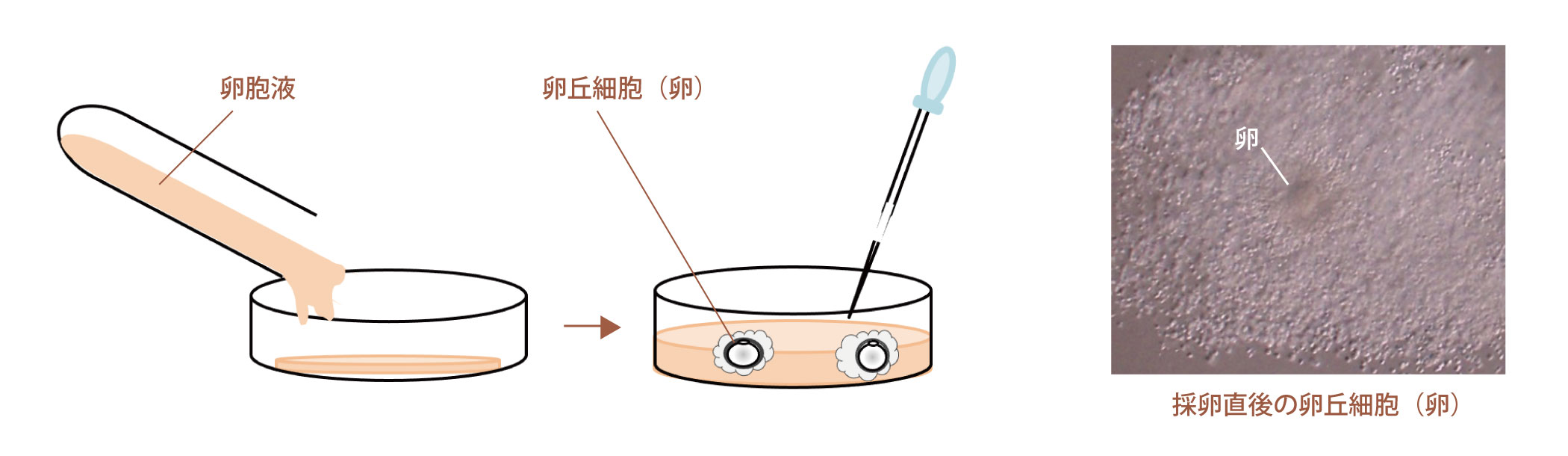 図：検卵