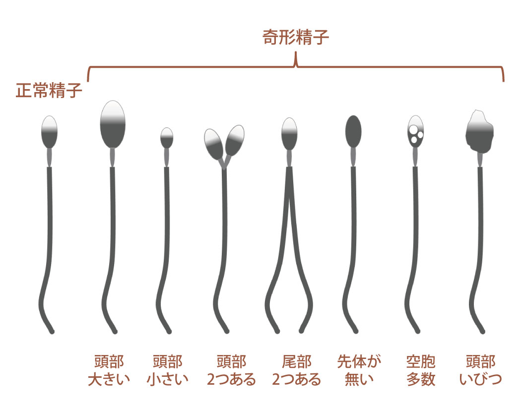 図：精子形態