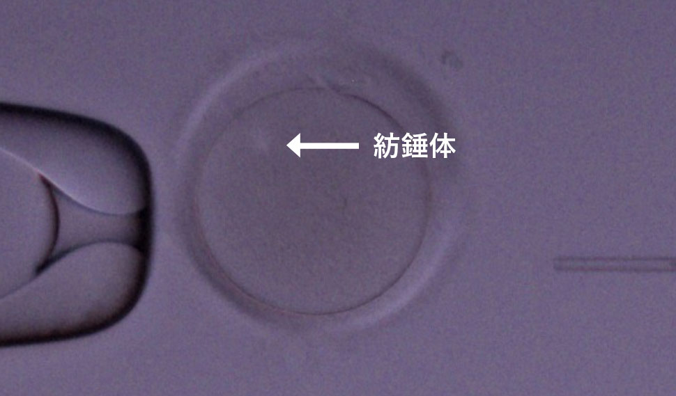 Photo：紡錘体可視装置