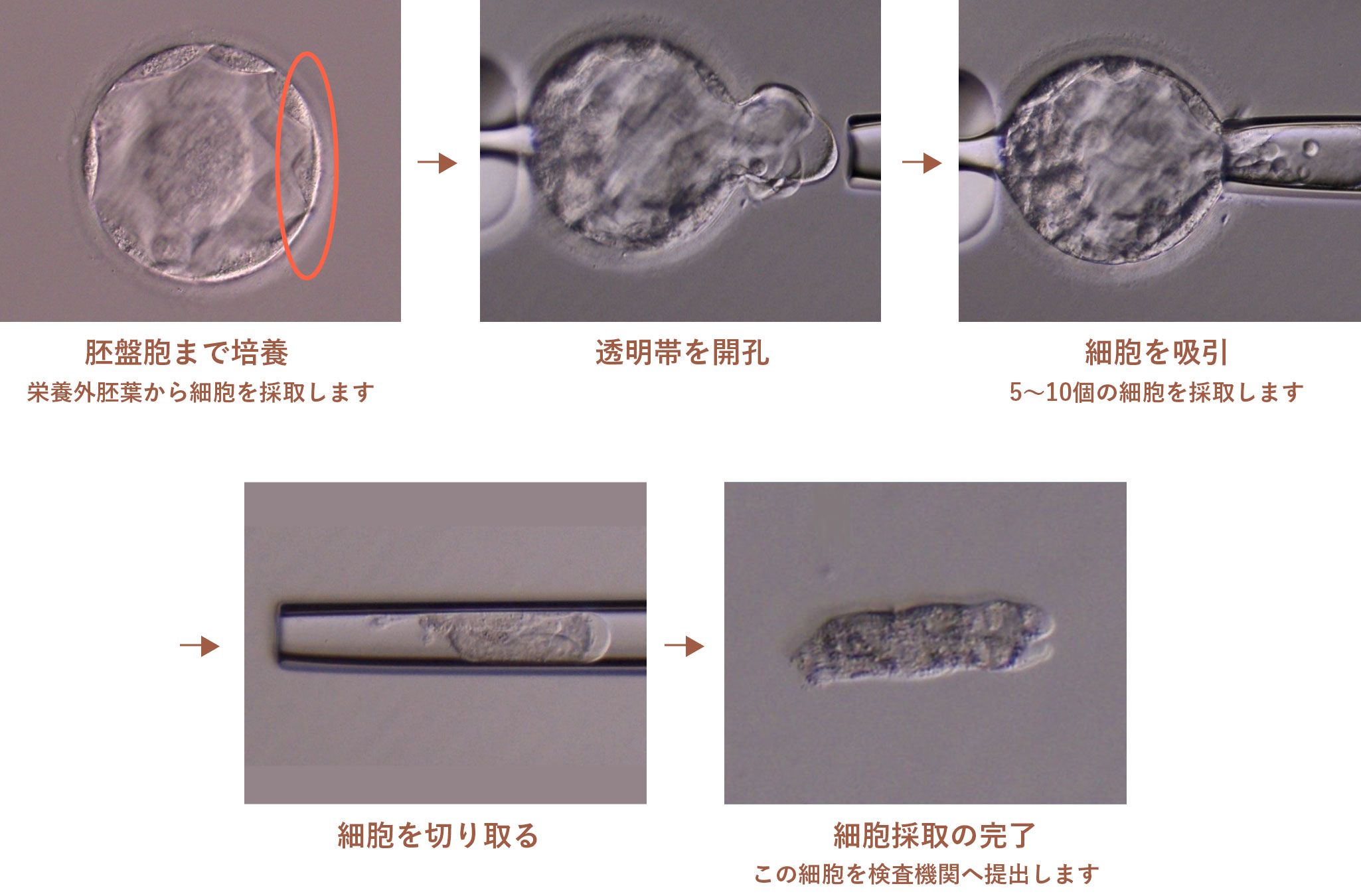 図：胚生検の方法